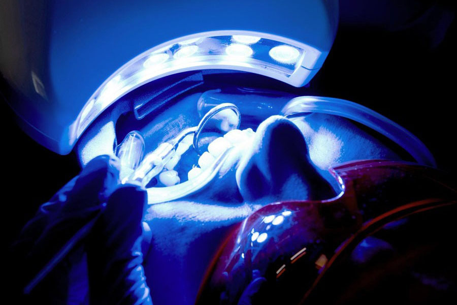 studio-dentistico-chiasso-sbiancamento3